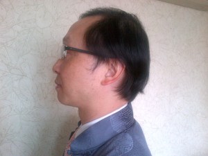 view from left side at 2 months