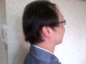 view from right side at 2 months