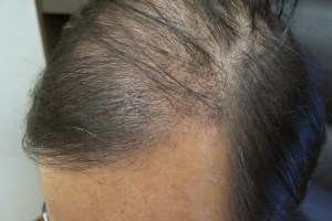 View from the side on Jan 16 2013