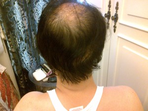 Day 4 view from the back before washing. There was still matting of hair together after sleep, and the view was slightly untidy.