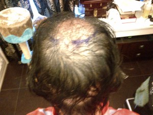 Bird's eye view mainly to recipient site 