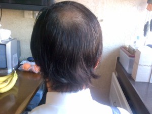 view from the back at 3 months