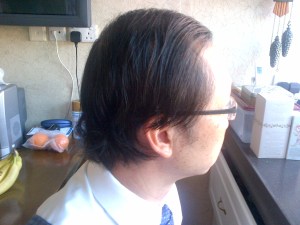 View from right side at 3 months