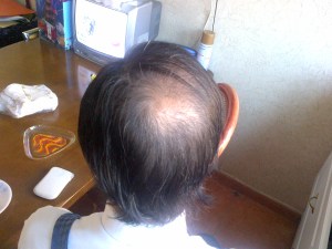 view from the top at 3 months