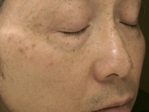 Right side of face Aug 20 2013